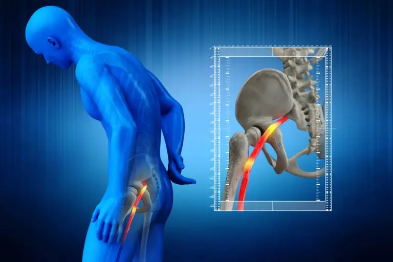 sciatic-nerve-illustration-1-768x512